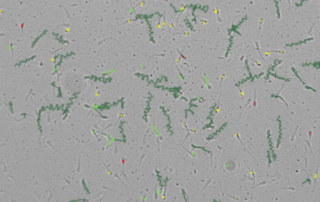 Image: Semen Motility