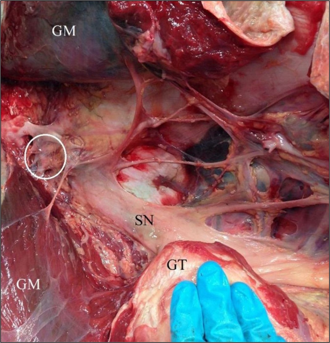 Figure 1 - The large flat sciatic nerve (SN) runs close to the skin, especially in low body condition cattle