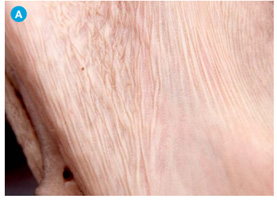 Tips for mitigating respiratory disease in cattle before risk periods
